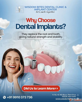 Affordable Dental Implant Cost in Delhi - Enquire Now