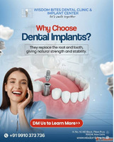 Affordable Dental Implant Cost in Delhi - Enquire Now