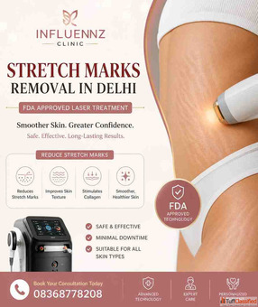 Stretch Marks Removal in Delhi Dr Geetika AIIMS MD
