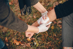 Immediate Burn Care and First Aid in Delhi