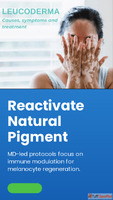 Homeopathy Treatment For Leucoderma by Aura Homeopathy