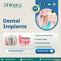 Dental Implants in Ahmedabad - Shinora Clinic