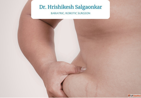 Get Expert Care for Obesity Treatment by Dr. Hrishikesh Salgaonkar