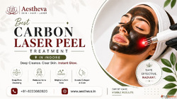 Best Carbon Laser Peel Treatment in Indore - Aestheva