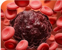 Hematologist Doctor in Hyderabad