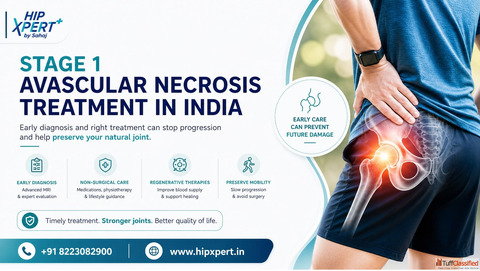 Stage 1 Avascular Necrosis Treatment in India - HipXpert