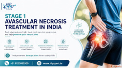 Stage 1 Avascular Necrosis Treatment in India - HipXpert
