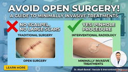 Minimally Invasive Pinhole Treatments for Faster Recovery