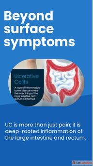 Homeopathy Treatment For Ulcerative Colitis Aura Homeopathy faridabad
