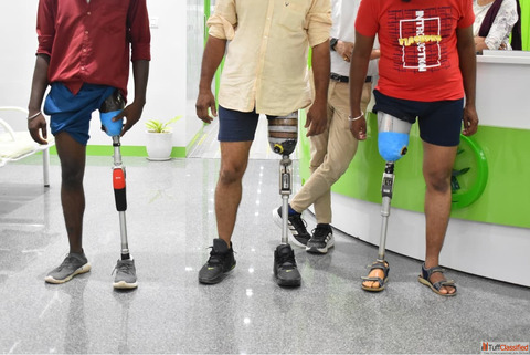 Best 3D Printed Artificial leg Affordable Artificial leg In Hyderabad