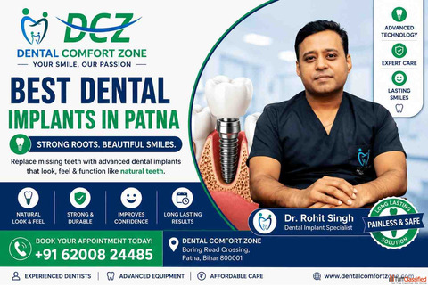 Best Dental Implants in Patna for a Confident Smile