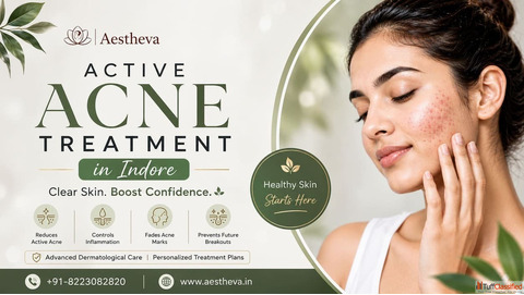 Active Acne Treatment in Indore - Aestheva