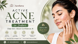 Active Acne Treatment in Indore - Aestheva