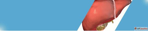 Gallbladder Stone Surgery Specialist in Ahmedabad Advanced Gastro Care