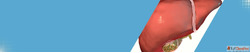 Gallbladder Stone Surgery Specialist in Ahmedabad Advanced G...