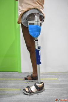 Best 3D Printed Artificial leg Affordable Artificial leg In Hyderabad