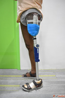 Best 3D Printed Artificial leg Affordable Artificial leg In ...