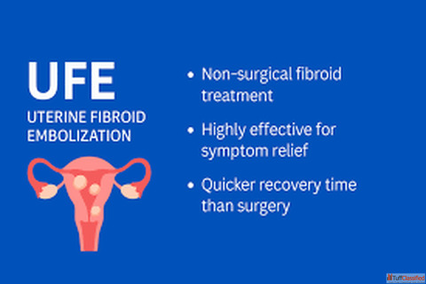 Advanced UFE Treatment for Uterine Fibroids in India