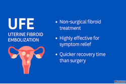 Advanced UFE Treatment for Uterine Fibroids in India