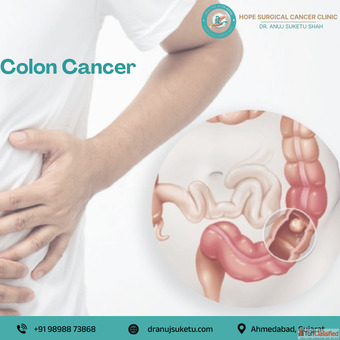 Dr. Anuj Suketu Shah - Trusted Colon Cancer Surgeon in Ahmedabad for Advanced Care