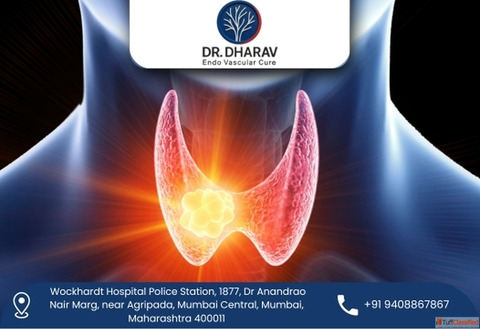 Get Relief from Thyroid Swelling with Expert Treatment