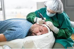 Best Hair care Clinic in Bangalore