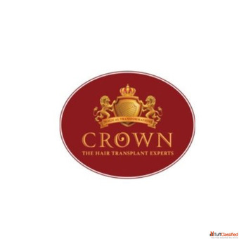 Crown - The Hair Transplant Experts