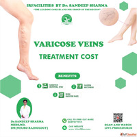 Best Varicose Veins Specialist for Advanced Vein Care and Tr...