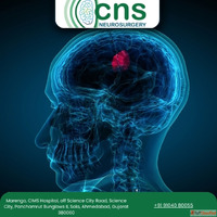 Dr. Chirag Solanki - Trusted Brain Tumor Surgery in Ahmedaba...