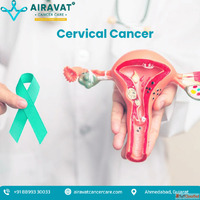 Best Cancer Hospital in Ahmedabad for Cervical Cancer Airava...
