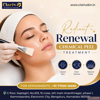Best Hair Transplant Clinic in Bangalore for Natural Results