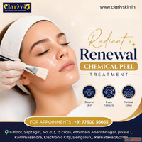Best Hair Transplant Clinic in Bangalore for Natural Results
