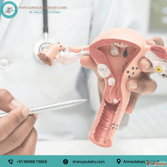 Advanced Uterus Cancer Treatment in Ahmedabad by an Expert Surgeon