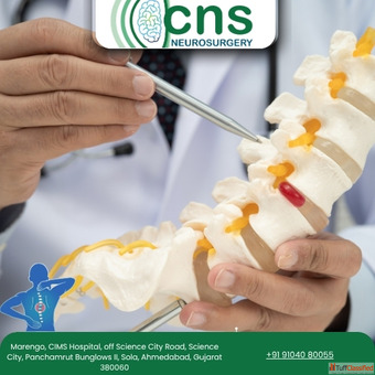 Advanced Spine Tumor Surgery in Ahmedabad - Expert Care by Dr. Chirag Solanki