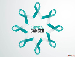 Cervical Cancer Screening Camp