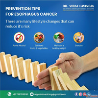 Get Trusted Esophageal Cancer Treatment in Ahmedabad for Bet...