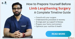 Prepare Yourself the Right Way Before Limb Lengthening Surge...