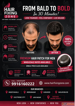 FROM BALD TO BOLD IN JUST 30 MINUTES