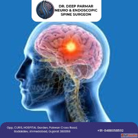 Advanced Brain Tumor Surgery in Ahmedabad by Dr. Deep Parmar