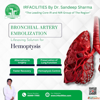 BAE Procedure with Advanced Interventional Radiology Method