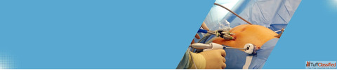 Advanced Gastro Laparoscopy Surgery in Ahmedabad for Faster Recovery