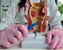 Advanced Care for Fistula and Fissure Problems in Delhi
