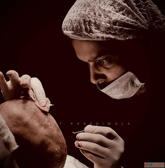 Hair Transplant in Indore - Best Hair Restoration Treatment for Natural Hair Growth