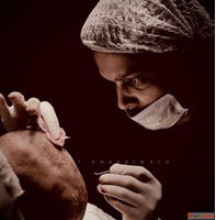 Hair Transplant in Indore - Best Hair Restoration Treatment ...