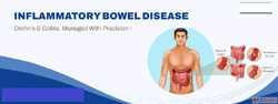 Inflammatory Bowel Disease Treatment - Advanced Care for Lon...