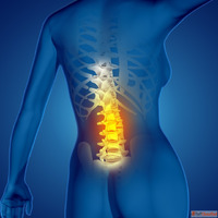 Sciatica Surgery Understanding Treatment Options