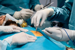 Gallbladder Stone Operation Understanding Treatment and Reco...