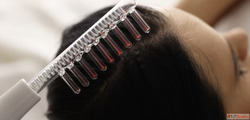 Advanced Hair Restoration Solutions in Gurgaon Estique clini...