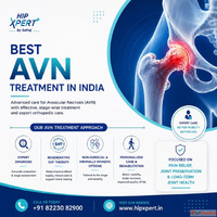 Best AVN Treatment in India - HipXpert