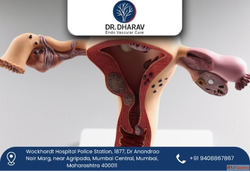 Uterine Fibroid Embolization by Dr. Dharav Kheradia
